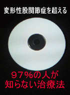 �ό`���Ҋ֐ߏǂ𒴂���I�@�X�V���̐l���m��Ȃ����Ö@�@CD �@