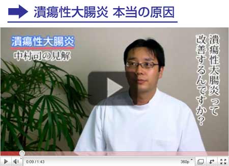潰瘍性大腸炎についての見解