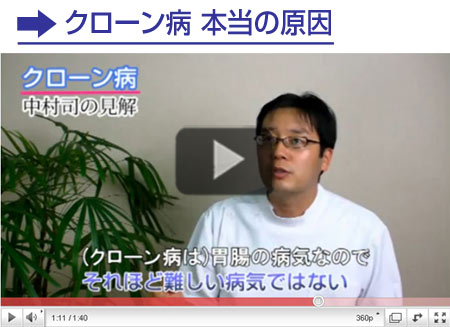 クローン病についての見解