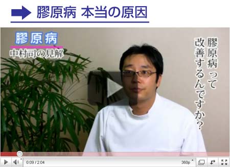 膠原病の見解