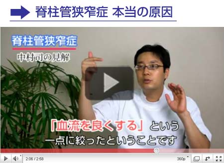脊柱管狭窄症の見解
